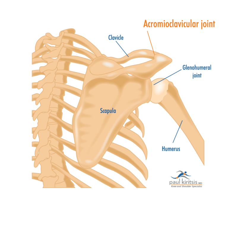 What Are the Signs of Arthritis in the Shoulder? - Paul Kiritsis, MD ...