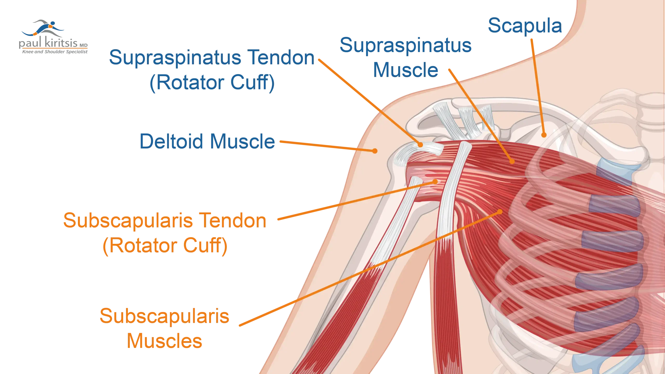 Anatomical Graphic of the Subscapularis and what it does.