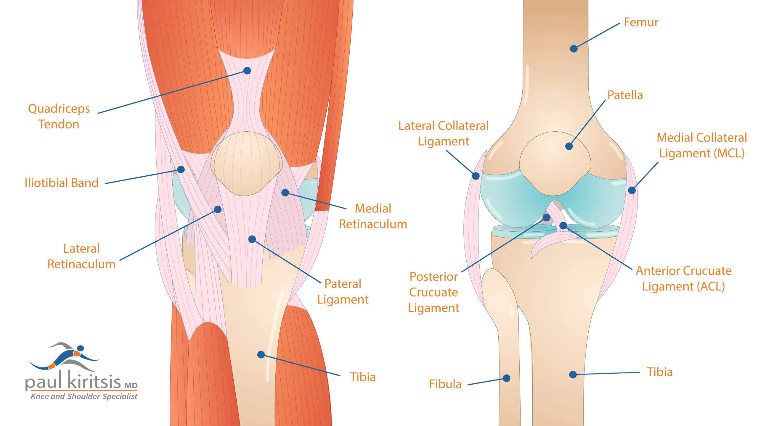 Patella Tendon Anatomy Transient Lateral Patellar Dislocation Patella Tendon Anatomy Transient Lateral Patellar Dislocation