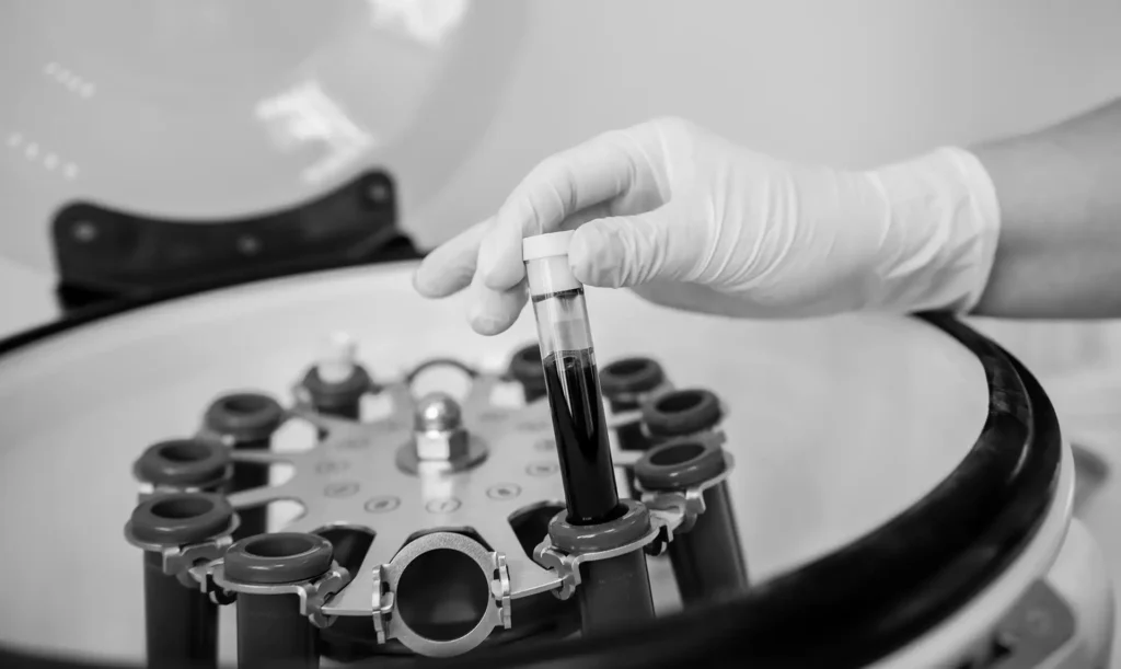 What Is a PRP Injection?