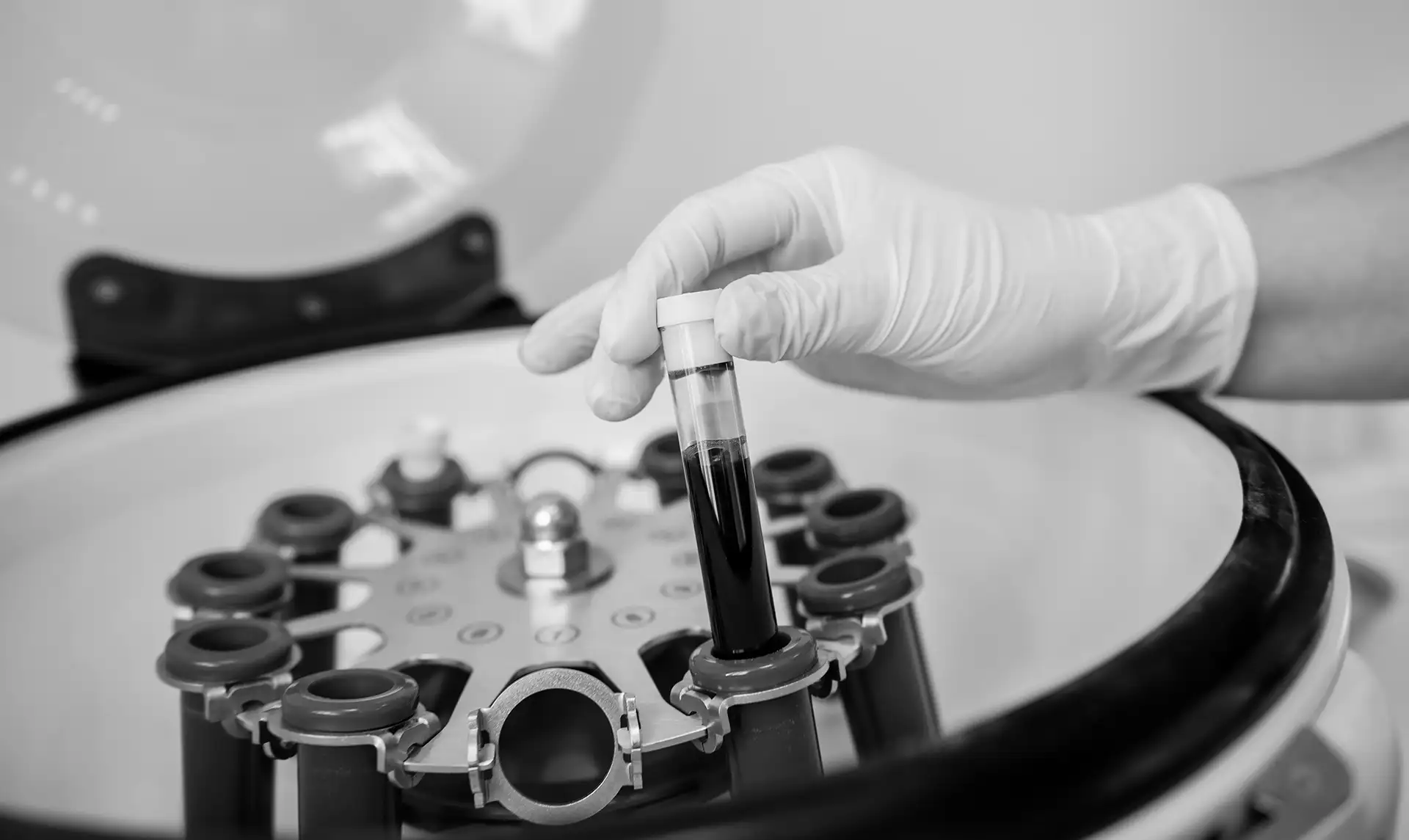 What Is a PRP Injection?