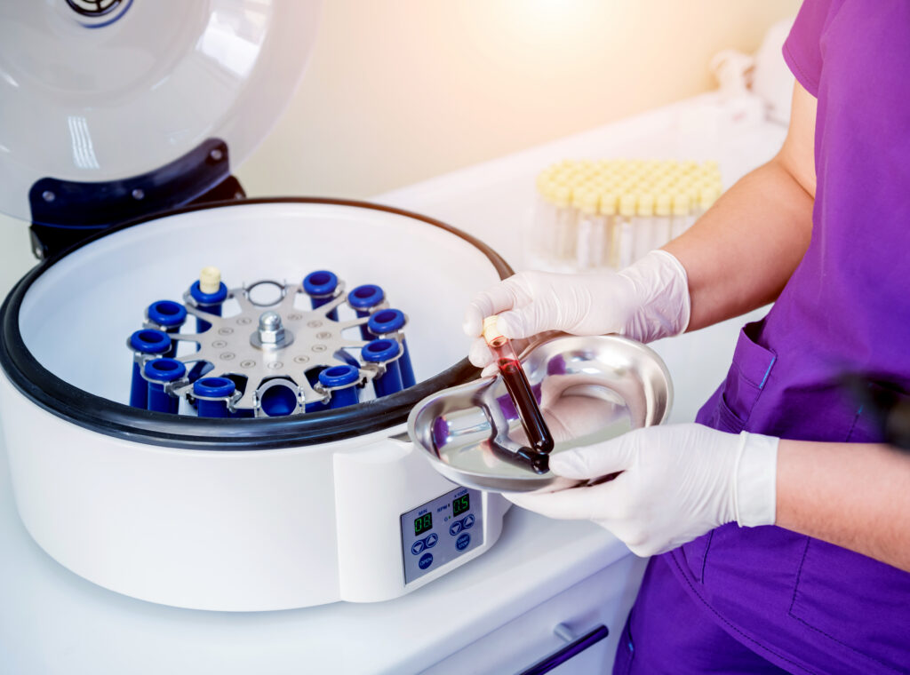 platelet-rich plasma preparation in a lab
