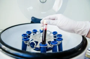 PRP centrifugation diagram