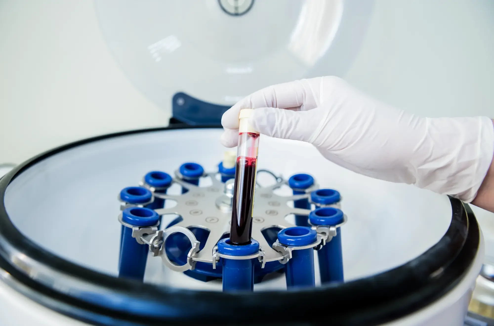 PRP centrifugation diagram